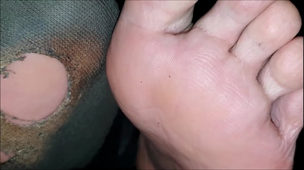 Ruined Toe Socks And Bare Feet Teasing You